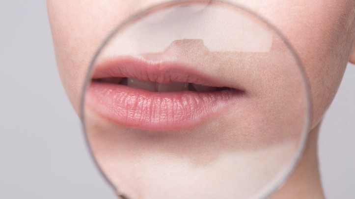 Black soldier fly larvae extract show potential for cosmetic application. [Getty Images]