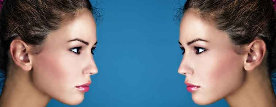 RoyalEpigen P5: rejuvenating the skin via epigenetic mechanisms