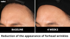 CelluCap: Tagra's Encapsulated Retinol & Vitamin A